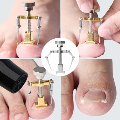 Desencravador de Unhas