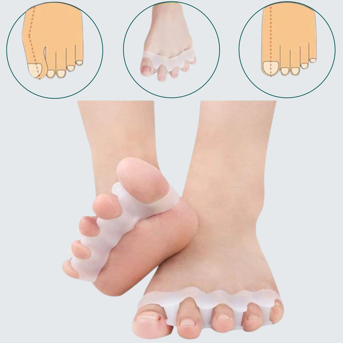 Corretor de Joanetes - Dedos sobrepostos