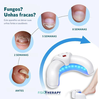NailCare: Tratamento e Fortalecimento das Unhas com LED UV