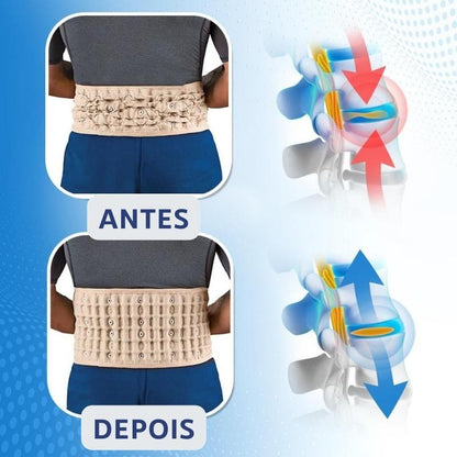 AirFlexLombar - Terapia Ortopédica para Lombar