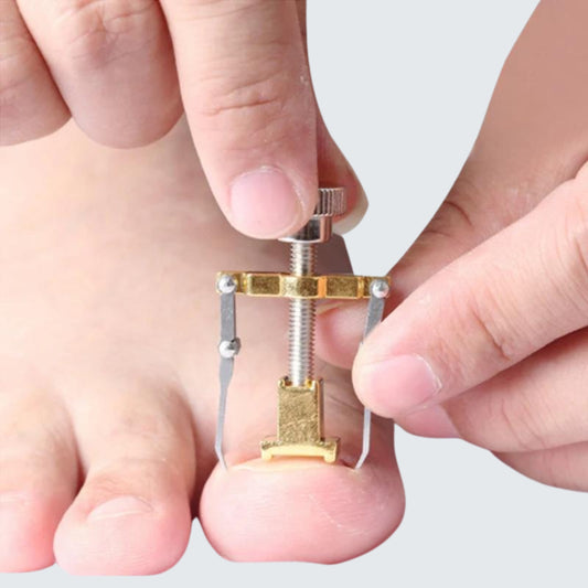 Desencravador de Unhas